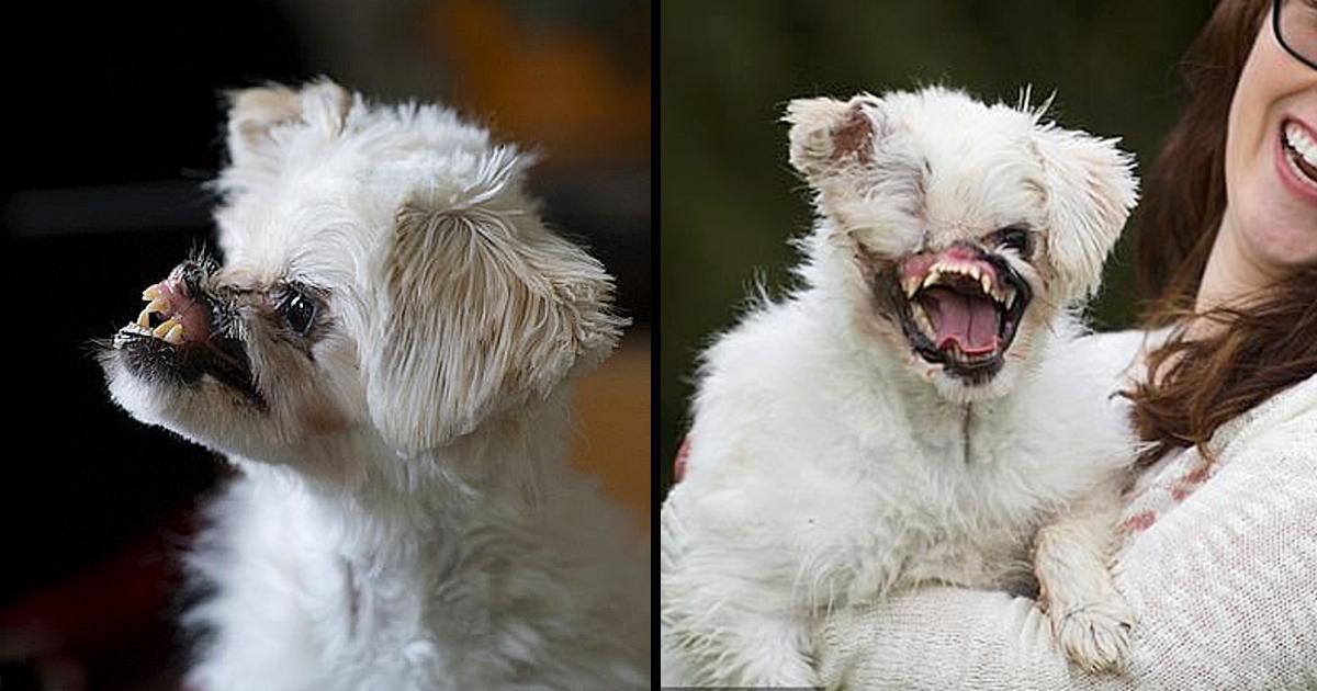 He suffered ear, nose, and eye losses as a result of an acid attack. but his smile remained constant