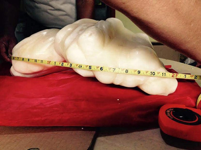 Fisherman Discovers Giant 75lb Pearl Worth $100 Million